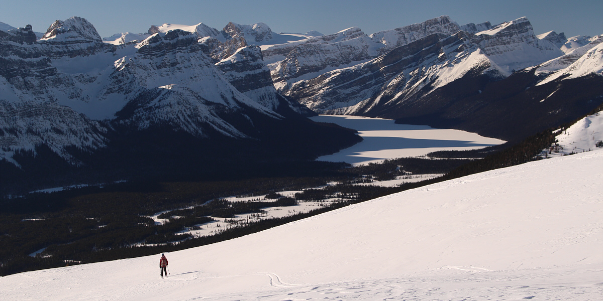 And people pay good money to ski at Lake Louise Ski Resort?