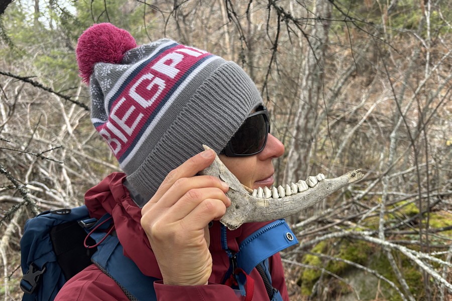 They're in better shape than my teeth!